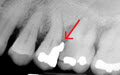 Many Problems with Speed Dentistry