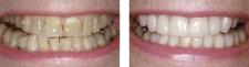 before & after