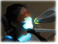 Zoom Teeth Whitening