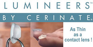 LUMINEERS BY CERINATE
