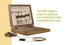 Digital X-Rays