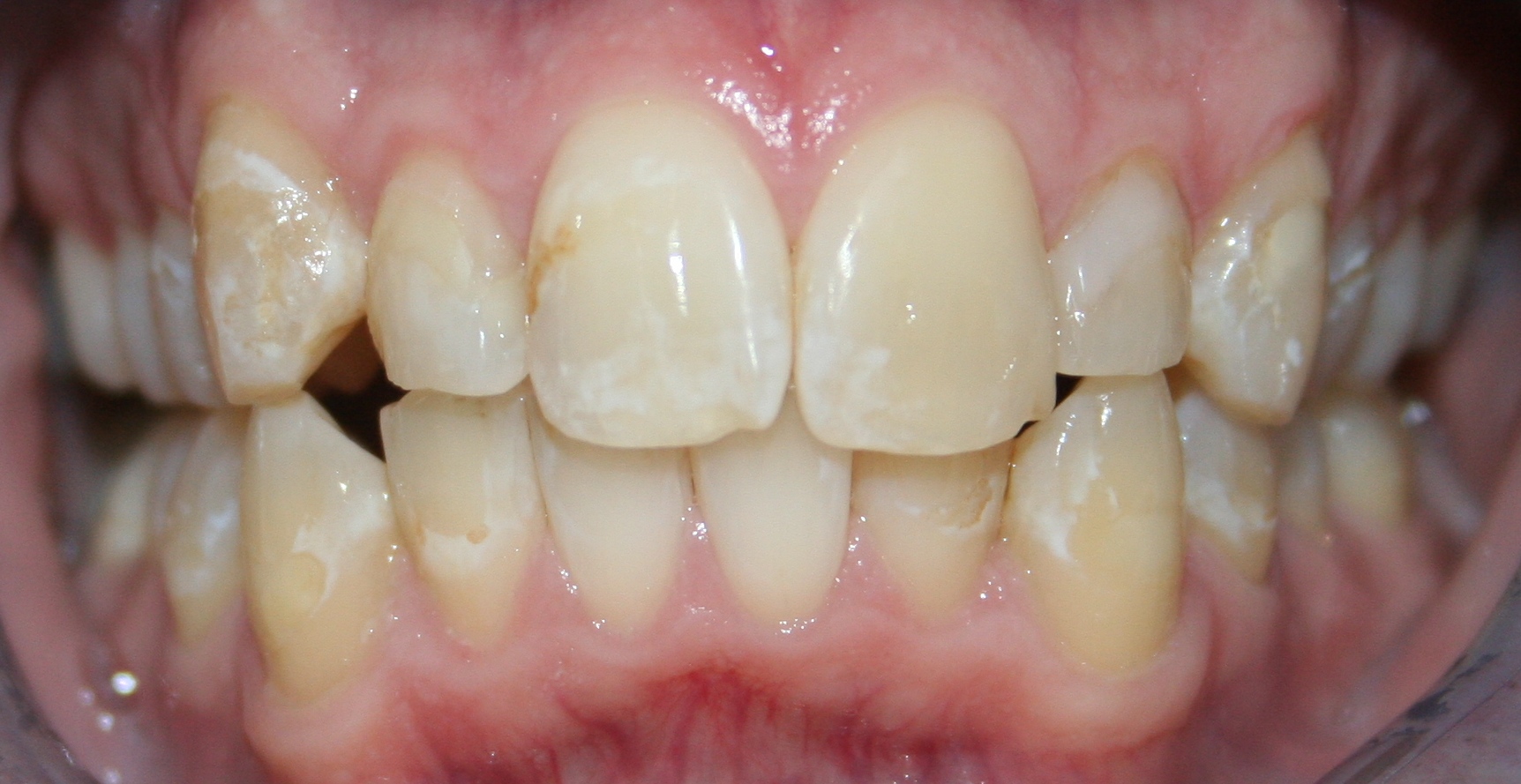 Herndon dentist