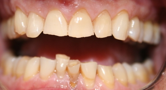 Dental Exams & Cleanings