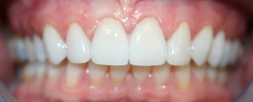 Great Falls dentist