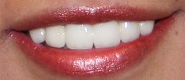 Reston cosmetic dentist